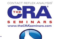 Contact Reflex Analysis [display]